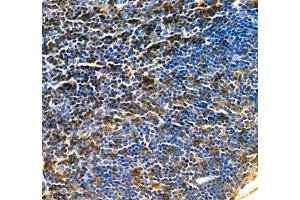 Immunohistochemistry of paraffin embedded mouse thymus using Lat (ABIN7074502) at dilution of 1: 2000 (400x lens)