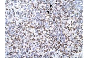 Image no. 1 for anti-Zinc Finger Protein 500 (ZNF500) (AA 348-397) antibody (ABIN6735775) (ZNF500 anticorps  (AA 348-397))