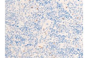 ABIN6267224 at 1/100 staining rat spleen tissue sections by IHC-P. (CHEK1 anticorps  (pSer317))