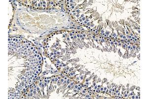 ABIN6258983 and ABIN6276069 at 1/100 staining rat testis tissue by IHC-P.