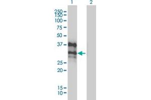 Western Blot analysis of DLX4 expression in transfected 293T cell line by DLX4 monoclonal antibody (M01), clone 1F11. (DLX4 anticorps  (AA 1-98))
