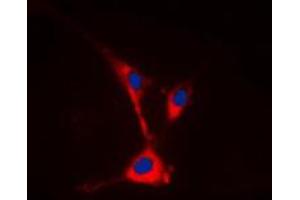Immunofluorescent analysis of TUSC3 staining in HeLa cells.
