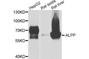 Western blot analysis of extracts of various cell lines, using ALPP antibody (ABIN5975263) at 1/1000 dilution. (PLAP anticorps)