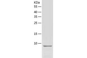 Chemokine (C-C Motif) Ligand 8 (CCL8) (AA 24-99) (Active) protein (His tag)