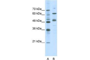 WB Suggested Anti-GATA4 Antibody Titration:  0. (GATA4 anticorps  (N-Term))