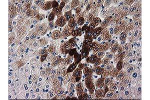 Image no. 3 for anti-Katanin P60 Subunit A-Like 1 (KATNAL1) antibody (ABIN1498985) (KATNAL1 anticorps)