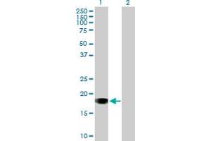 Western Blot analysis of SNX20 expression in transfected 293T cell line by SNX20 MaxPab polyclonal antibody.