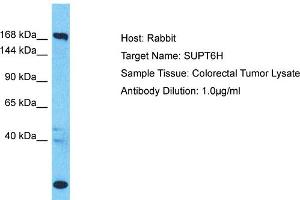 Host: Rabbit Target Name: SUPT6H Sample Type: Colorectal Tumor lysates Antibody Dilution: 1. (Spt6 anticorps  (C-Term))