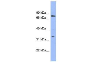 WB Suggested Anti-PATZ1 Antibody Titration:  0. (PATZ1 anticorps  (N-Term))