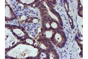 Immunohistochemistry (IHC) image for anti-Spermine Synthase, SMS (SMS) antibody (ABIN1501093)