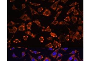 Immunofluorescence analysis of L929 cells using IL18 Polyclonal Antibody at dilution of 1:100. (IL-18 anticorps)