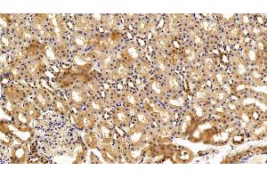 Detection of C3a in Rat Kidney Tissue using Polyclonal Antibody to Complement Component 3a (C3a)