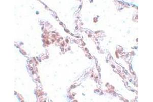 Immunohistochemistry staining of human lung tissue (Paraffin section) using TMEM184B Antibody  at 5 μg/ml.