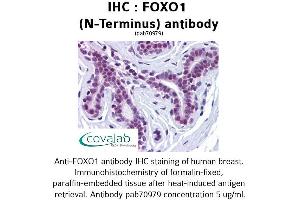 Image no. 1 for anti-Forkhead Box O1 (FOXO1) (N-Term) antibody (ABIN1734423) (FOXO1 anticorps  (N-Term))