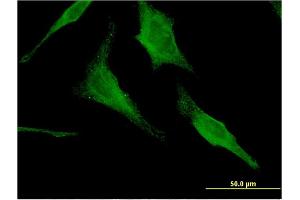 Immunofluorescence of monoclonal antibody to HEXA on HeLa cell. (Hexosaminidase A anticorps  (AA 1-529))