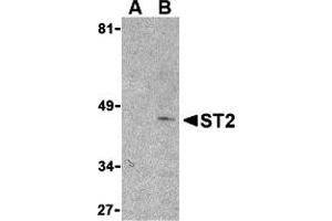 Western Blotting (WB) image for anti-Interleukin 1 Receptor-Like 1 (IL1RL1) (N-Term) antibody (ABIN1031587) (IL1RL1 anticorps  (N-Term))