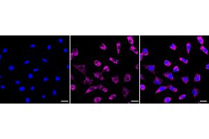 Immunocytochemical staining of Hela cells with HAPLN1 antibody (ABIN7799008), 1:1,000). (Recombinant HAPLN1 anticorps)