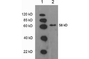 Western blot analysis: Lane 1: EasyWestern Protein Standard   Lane 2. (ATP6V1B2 anticorps)