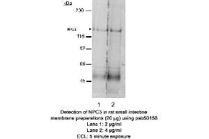anti-Niemann-Pick Type C1 Like-1 (AA 500-600), (Internal Region) antibody