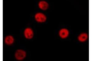 ABIN6277499 staining  NIH-3T3 cells by IF/ICC. (ERCC1 anticorps  (Internal Region))