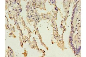 Immunohistochemistry of paraffin-embedded human lung tissue using ABIN7142610 at dilution of 1:100 (MTHFS anticorps  (AA 2-203))