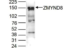 Western Blot of anti-ZMYND8 antibody Western Blot results of Rabbit anti-ZMYND8 antibody.