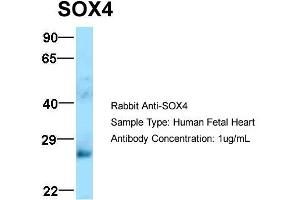 Host: Rabbit  Target Name: SOX4  Sample Tissue: Human Fetal Heart  Antibody Dilution: 1. (SOX4 anticorps  (N-Term))