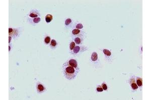 Immunocytochemistry analysis of MCF-7 cells using ABIN7139274 at dilution of 1:100