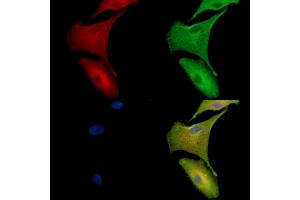 ABIN7096940 and ABIN7101006 staining  cells by IF/ICC. (TMEM63B anticorps)