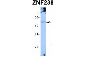 Host:  Rabbit  Target Name:  ZNF238  Sample Type:  Human Adult Placenta  Antibody Dilution:  1.