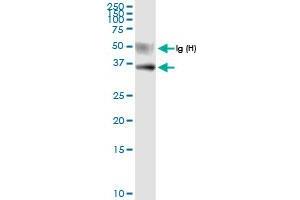 anti-Ubiquitin Specific Peptidase 18 (USP18) (AA 1-372) antibody
