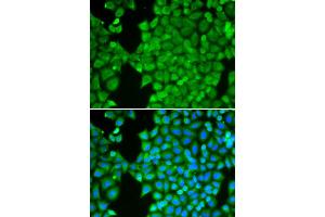 Immunofluorescence analysis of HeLa cell using CA3 antibody. (CA3 anticorps)