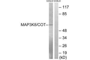 Western Blotting (WB) image for anti-Mitogen-Activated Protein Kinase Kinase Kinase 8 (MAP3K8) (Ser400) antibody (ABIN1848230)
