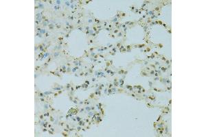 Immunohistochemistry of paraffin-embedded rat lung using SAFB antibody.