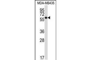Western blot analysis in MDA-MB435 cell line lysates (35ug/lane).