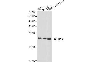 Western blot analysis of extracts of various cell lines, using SFTPC antibody. (Surfactant Protein C anticorps)