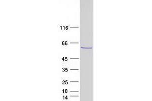 Validation with Western Blot