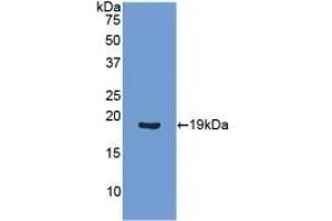 Detection of Recombinant ANGPT1, Human using Polyclonal Antibody to Angiopoietin 1 (ANGPT1) (Angiopoietin 1 anticorps  (AA 284-452))
