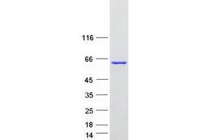 Validation with Western Blot
