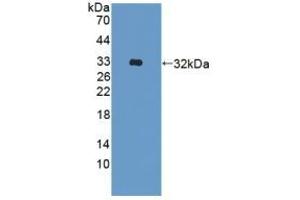 Detection of Recombinant ADAM33, Human using Polyclonal Antibody to A Disintegrin And Metalloprotease 33 (ADAM33) (ADAM33 anticorps  (AA 210-503))