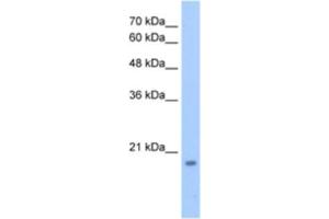Western Blotting (WB) image for anti-Deoxynucleotidyltransferase, Terminal, Interacting Protein 1 (DNTTIP1) antibody (ABIN2463366) (DNTTIP1 anticorps)