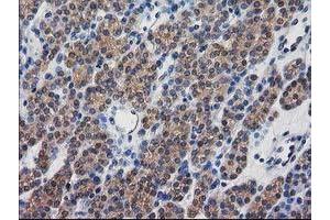 Image no. 5 for anti-Destrin (Actin Depolymerizing Factor) (DSTN) antibody (ABIN1497908)