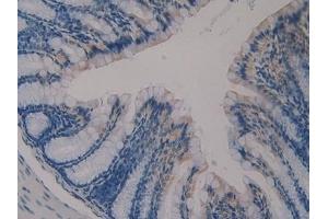 Detection of KL in Mouse Colon Tissue using Polyclonal Antibody to Klotho (KL)