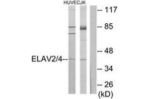 Western blot analysis of extracts from Jurkat/HuvEc cells, using ELAV2/4 Antibody.