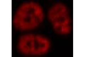 ABIN6269115 staining A549 by IF/ICC.