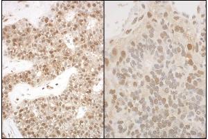 anti-Proteasome Subunit alpha 5 (PSMA5) (AA 100-150) antibody