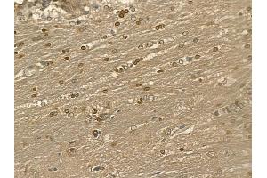 LBX1 Mouse Monoclonal Antibody at 1/100 staining rat brain tissue by IHC-P. (Lbx1 anticorps)