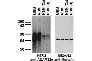 Immunoblot versus brain membranes from whole rat (RBM) and mouse (MBM) brain, and from human cerebral cortex [HBM(Cx)] and hippocampus [HBM(H)].