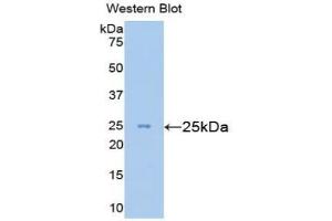 ESAM anticorps  (AA 29-248)