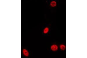 ABIN6275533 staining Hela by IF/ICC. (PDIK1L anticorps  (Internal Region))